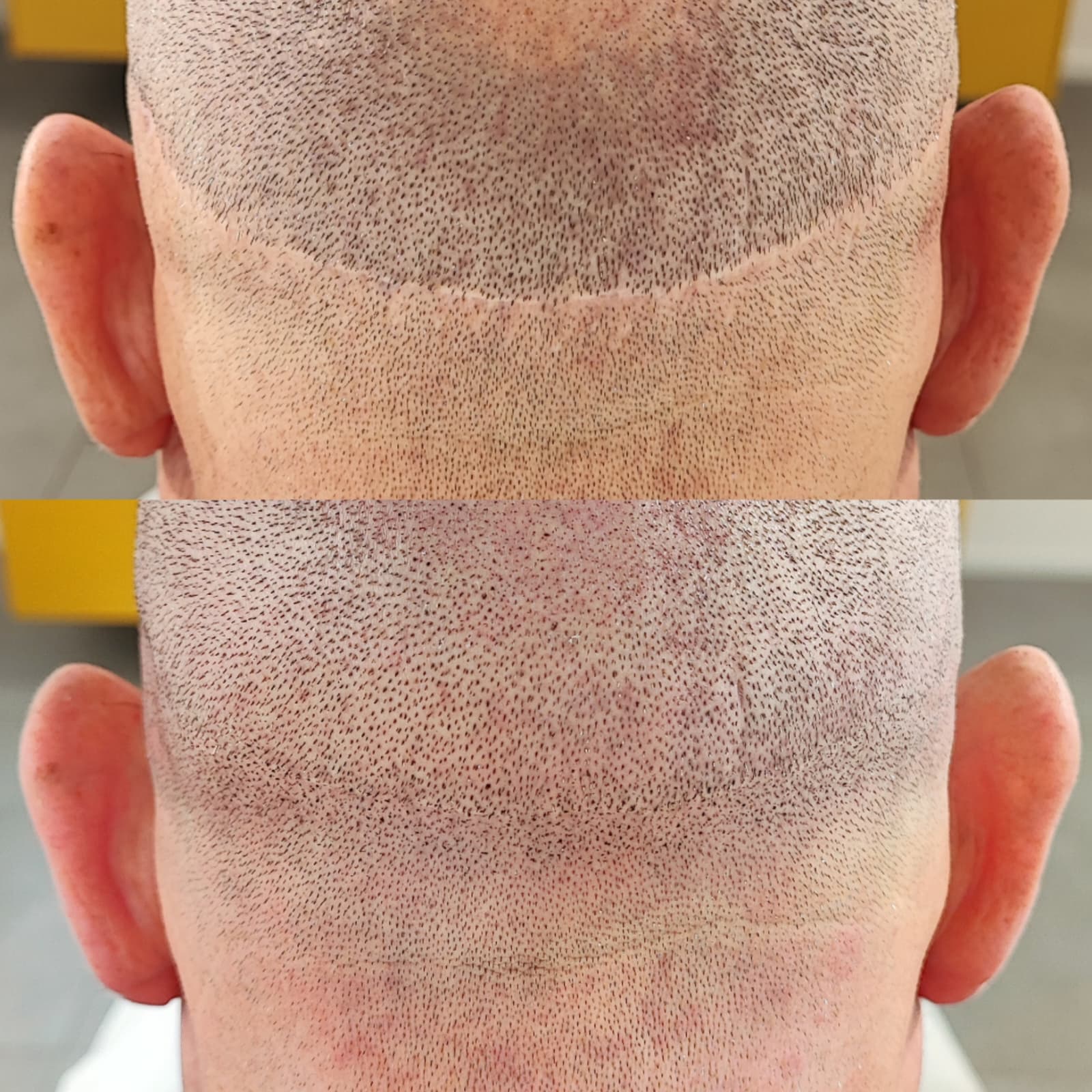 Risultato trattamento prima e dopo