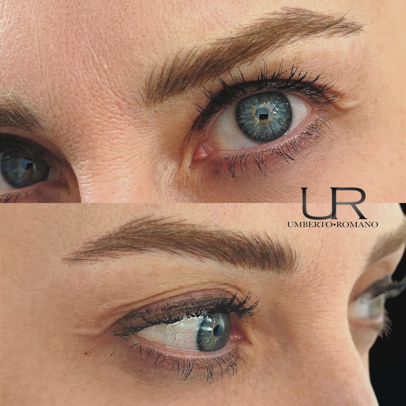 Risultato trattamento prima e dopo