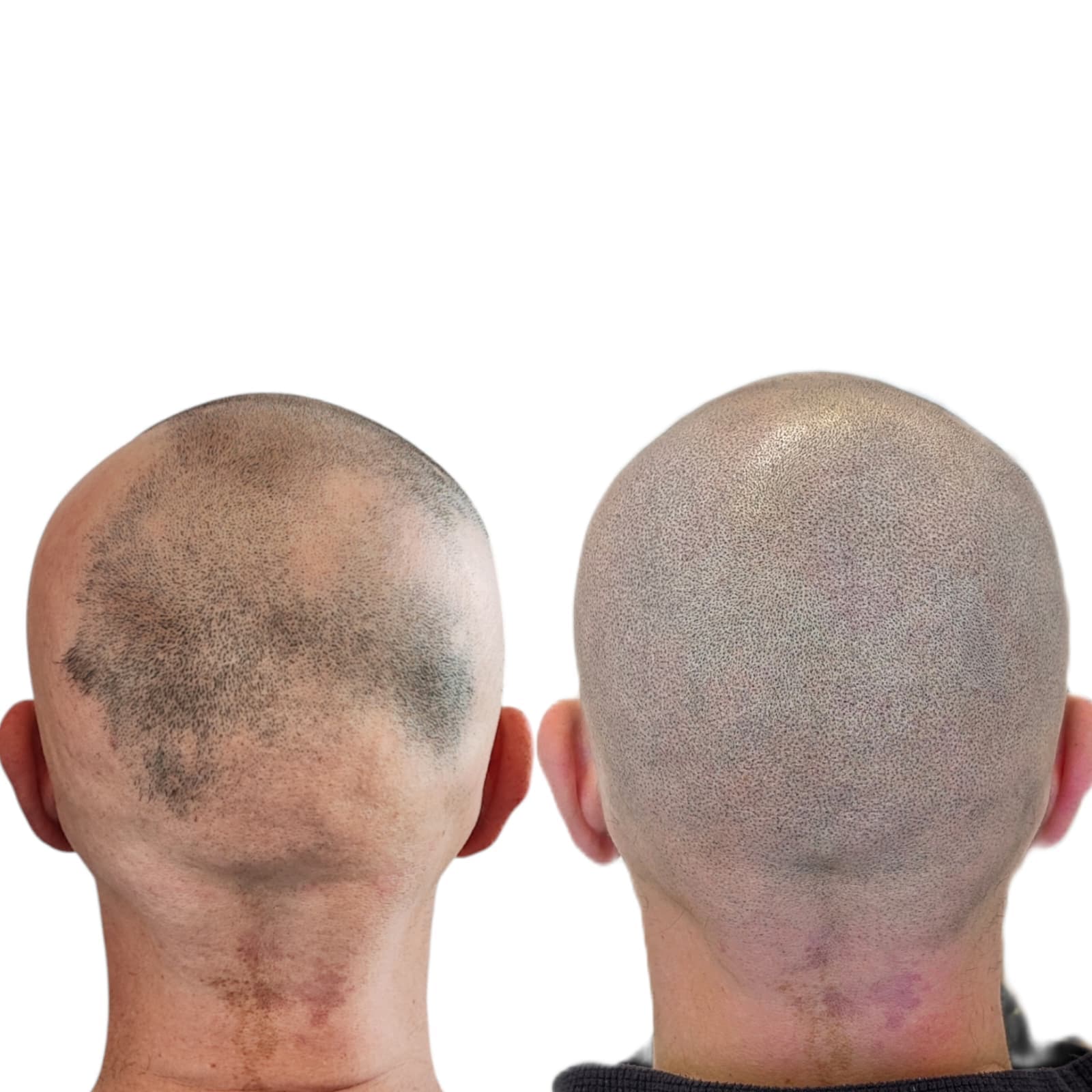 Risultato trattamento prima e dopo