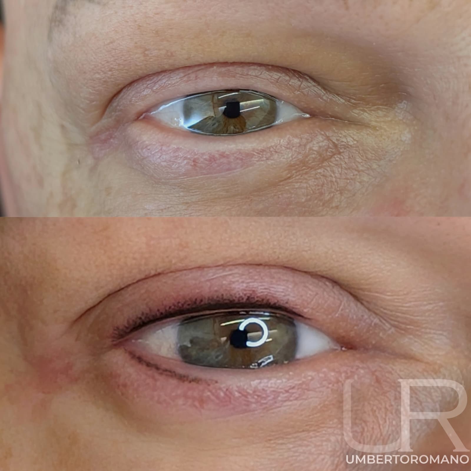 Risultato trattamento prima e dopo