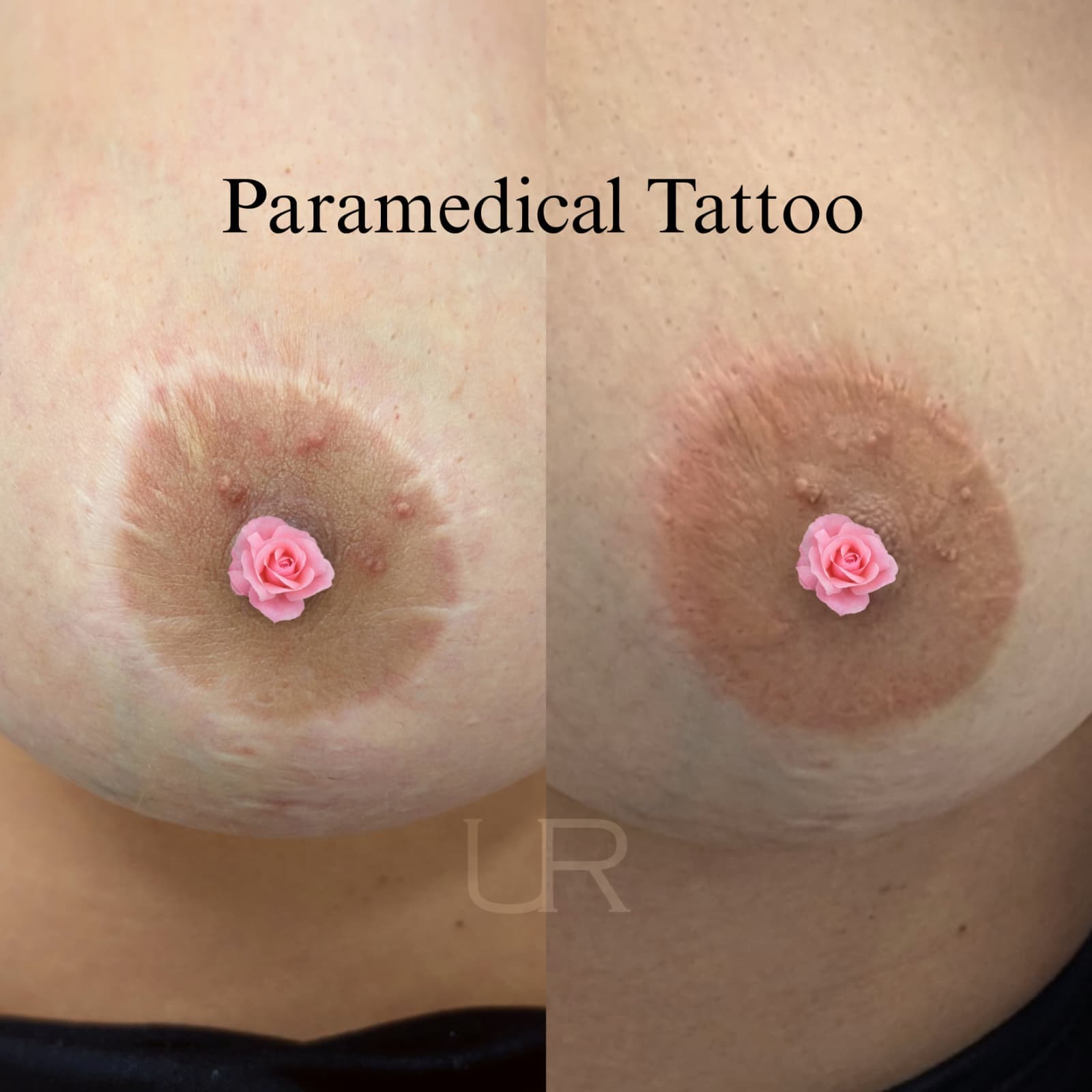 Risultato trattamento prima e dopo